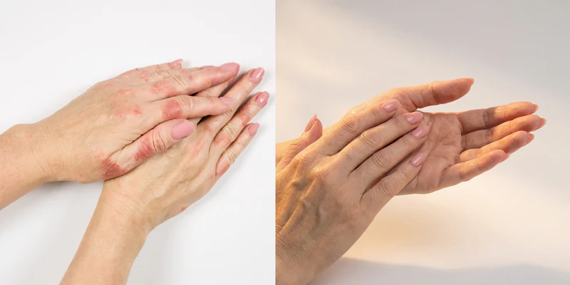 Skin irritation concern