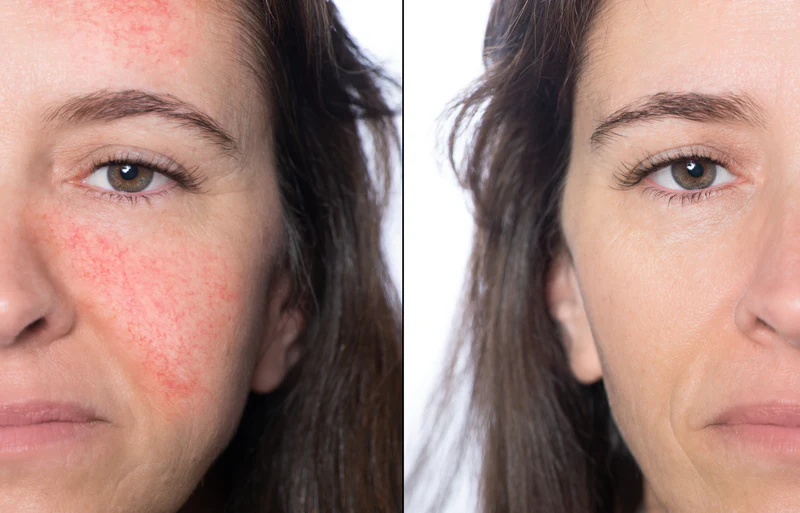Everyday skin support